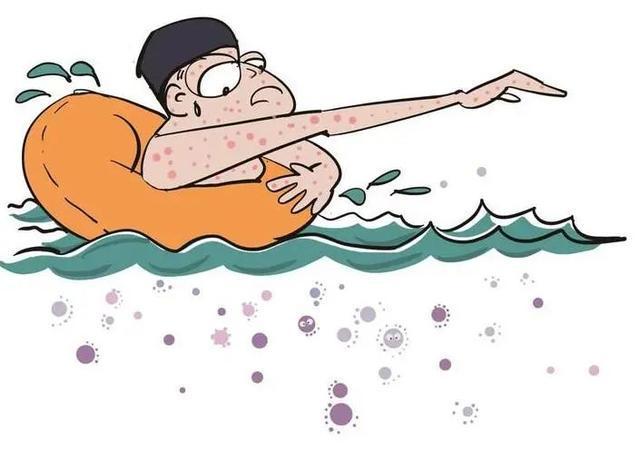 1717384878619797.jpeg 游泳池細(xì)菌2.jpeg